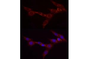 Immunofluorescence analysis of NIH/3T3 cells using Bcdin3d Rabbit pAb (ABIN7265842) at dilution of 1:25 (40x lens). (BCDIN3D 抗体)