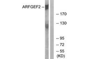 Western Blotting (WB) image for anti-ADP-Ribosylation Factor Guanine Nucleotide-Exchange Factor 2 (Brefeldin A-Inhibited) (ARFGEF2) (AA 1491-1540) antibody (ABIN2890171) (ARFGEF2 抗体  (AA 1491-1540))