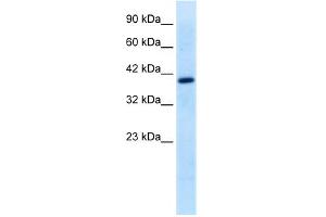 WB Suggested Anti-TFEB Antibody Titration:  0. (TFEB 抗体  (Middle Region))