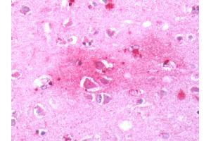 Immunohistochemistry (Paraffin-embedded Sections) (IHC (p)) image for anti-Corticotropin Releasing Hormone Receptor 1 (CRHR1) (N-Term) antibody (ABIN1048463)