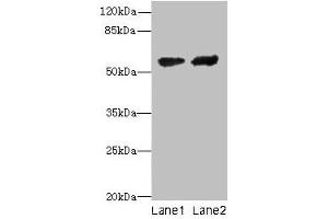 Western blot All lanes: CYP17A1 antibody at 12 μg/mL Lane 1: Hela whole cell lysate Lane 2: A549 whole cell lysate Secondary Goat polyclonal to rabbit IgG at 1/10000 dilution Predicted band size: 58 kDa Observed band size: 58 kDa (CYP17A1 抗体  (AA 24-508))