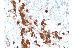 Formalin-fixed, paraffin-embedded human Pituitary stained with ACTH Monoclonal Antibody (SPM333). (POMC 抗体  (AA 1-24))
