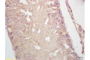 Immunohistochemistry (IHC) image for anti-Glutamate Decarboxylase 2 (Pancreatic Islets and Brain, 65kDa) (GAD2) (AA 501-585) antibody (ABIN668140)