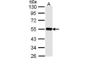WB Image Sample (30 ug of whole cell lysate) A: Molt-4 , 10% SDS PAGE antibody diluted at 1:1000 (TRIM21 抗体)