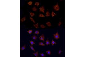 Immunofluorescence analysis of L929 using CPT1C antibody (ABIN6130131, ABIN6138980, ABIN6138981 and ABIN6217987) at dilution of 1:100. (CPT1C 抗体  (AA 270-400))