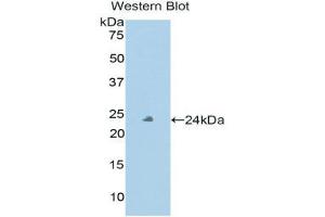 Western Blotting (WB) image for anti-Peroxidasin Homolog (PXDN) (AA 76-260) antibody (ABIN1860379) (Peroxidasin 抗体  (AA 76-260))