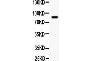 Anti- Gelsolin antibody, Western blotting All lanes: Anti Gelsolin  at 0.
