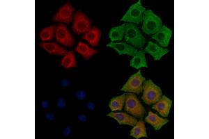ABIN6257947 and ABIN6275876 staining Hela cells by IF/ICC.
