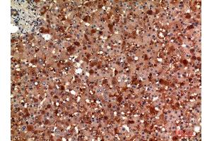Immunohistochemistry (IHC) analysis of paraffin-embedded Human Liver, antibody was diluted at 1:100. (AGT 抗体  (Internal Region))