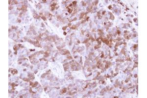 IHC-P Image Immunohistochemical analysis of paraffin-embedded H520 xenograft, using Factor XIIIa, antibody at 1:500 dilution. (F13A1 抗体  (N-Term))