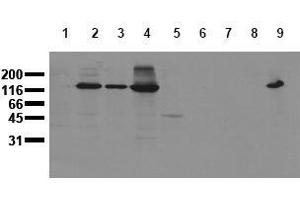 Western Blotting (WB) image for anti-Cadherin 2 (CDH2) antibody (ABIN126737) (N-Cadherin 抗体)