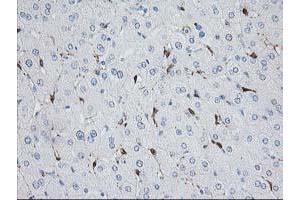 Image no. 4 for anti-NudE Nuclear Distribution E Homolog (A. Nidulans)-Like 1 (NDEL1) antibody (ABIN1499853)