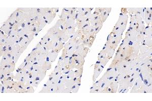 Immunohistochemistry (IHC) image for anti-Sema Domain, Seven Thrombospondin Repeats (Type 1 and Type 1-Like), Transmembrane Domain (TM) and Short Cytoplasmic Domain, (Semaphorin) 5B (SEMA5B) (AA 836-1013) antibody (ABIN7437377)