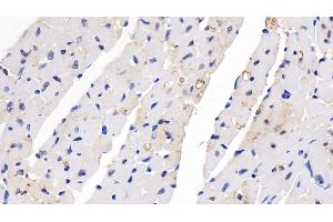 Detection of SEMA5B in Mouse Cardiac Muscle Tissue using Polyclonal Antibody to Semaphorin 5B (SEMA5B) (SEMA5B 抗体  (AA 836-1013))