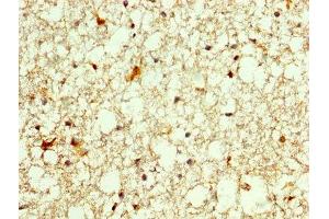 IHC image of ABIN7155839 diluted at 1:250 and staining in paraffin-embedded human brain tissue performed on a Leica BondTM system. (OTX2 抗体  (AA 1-297))