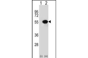 Western blot analysis of RUVBL1 (arrow) using rabbit polyclonal RUVBL1 Antibody (ABIN650671 and ABIN2838241). (RUVBL1 抗体)