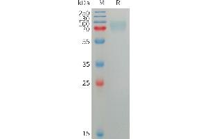 SDS-PAGE (SDS) image for Sialic Acid Binding Ig-Like Lectin 5 (SIGLEC5) (AA 17-434) protein (His tag) (ABIN7491367)