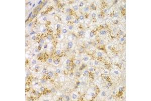 Immunohistochemistry (Paraffin-embedded Sections) (IHC (p)) image for anti-Actinin, alpha 1 (ACTN1) (AA 1-330) antibody (ABIN3021587)