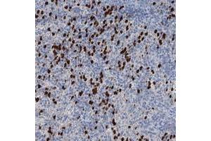 Immunohistochemical staining of human spleen with OTOA polyclonal antibody  shows strong cytoplasmic positivity in cells of red pulp at 1:50-1:200 dilution. (OTOA 抗体)