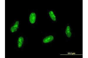 Immunofluorescence (IF) image for anti-Sin3A-Associated Protein, 30kDa (SAP30) (AA 131-219) antibody (ABIN563815)