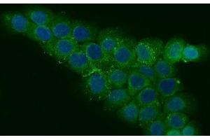 IF analysis of CCDC115 using anti-CCDC115 antibody (ABIN7599042).