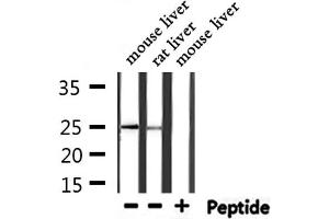 Western Blotting (WB) image for anti-Ferritin, Light Polypeptide (FTL) (C-Term) antibody (ABIN6261826)