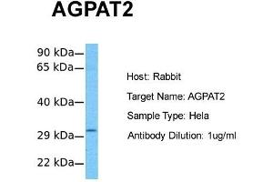 Host:  Rabbit  Target Name:  AGPAT2  Sample Tissue:  Human Hela  Antibody Dilution:  1. (AGPAT2 抗体  (C-Term))