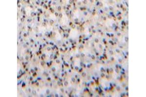 IHC-P analysis of Kidney tissue, with DAB staining. (TCF20 抗体  (AA 1656-1792))