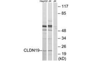 Western blot analysis of extracts from Jurkat/HepG2 cells, using CLDN19 Antibody. (Claudin 19 抗体  (AA 81-130))