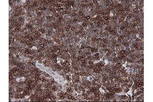 Immunohistochemistry (IHC) image for anti-T-cell surface glycoprotein CD1c (CD1C) antibody (ABIN2670660) (CD1c 抗体)