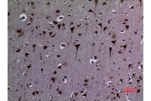 Immunohistochemical analysis of paraffin-embedded human-brain, antibody was diluted at 1:100. (HSP90 抗体  (acLys284, acLys292))