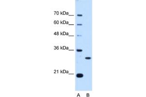 Western Blotting (WB) image for anti-PSME3 (PSME3) antibody (ABIN2462948) (PSME3 抗体)