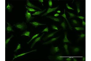 Immunofluorescence of monoclonal antibody to VCP on HeLa cell. (VCP 抗体  (AA 221-310))