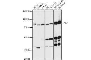 Western blot analysis of extracts of various cell lines, using NSF antibody (ABIN6130571, ABIN6144871, ABIN6144872 and ABIN6214029) at 1:3000 dilution.