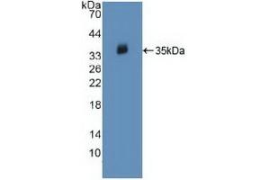 Detection of Recombinant JAK2, Human using Polyclonal Antibody to Janus Kinase 2 (JAK2) (JAK2 抗体  (AA 508-800))