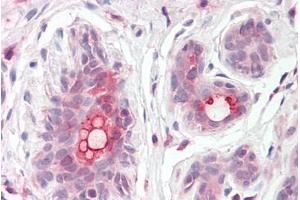 Immunohistochemistry (IHC) image for anti-ATP-Binding Cassette, Sub-Family C (CFTR/MRP), Member 11 (ABCC11) (Internal Region) antibody (ABIN302164)