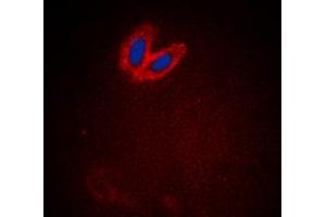 Immunofluorescent analysis of ACK1 (pY284) staining in HeLa cells. (TNK2 抗体  (pTyr284))