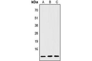 Western blot analysis of IGFL2 expression in Jurkat (A), NIH3T3 (B), H9C2 (C) whole cell lysates. (IGFL2 抗体  (Center))