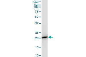 RPS7 polyclonal antibody (A01). (RPS7 抗体  (AA 95-194))