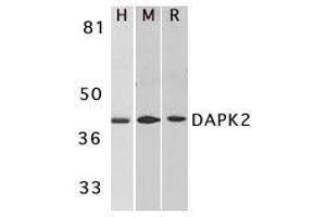 Western blot analysis of DAPK2 in A431 (H), mouse spleen (M), and rat kidney (R) lysates with DAPK2 antibody at 1μg/ml. (DAPK2 抗体  (AA 356-370))