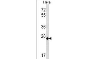 MT-CO3 Antibody (N-term) (ABIN1539412 and ABIN2838144) western blot analysis in Hela cell line lysates (35 μg/lane). (COX3 抗体  (N-Term))