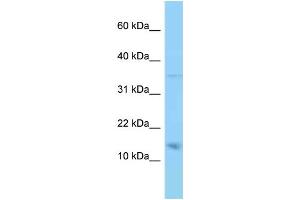 WB Suggested Anti-PMP22 Antibody Titration: 1. (PMP22 抗体  (N-Term))