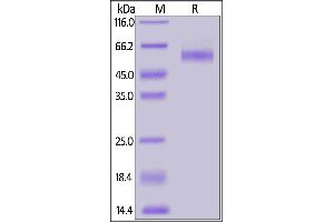 SDS-PAGE (SDS) image for Transforming Growth Factor, beta Receptor II (70/80kDa) (TGFBR2) (AA 23-159) (Active) protein (Fc Tag,AVI tag,Biotin) (ABIN6973281)