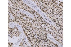 IHC analysis of PC4/SUB1 using anti-PC4/SUB1 antibody (ABIN7602185).