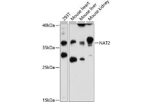 Western blot analysis of extracts of various cell lines, using N antibody (ABIN6132387, ABIN6144378, ABIN6144379 and ABIN6216511) at 1:3000 dilution. (NAT2 抗体  (AA 171-290))