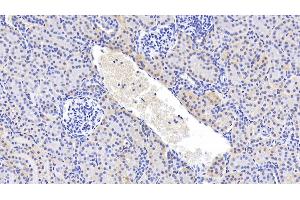 Detection of GPC4 in Human Kidney Tissue using Polyclonal Antibody to Glypican 4 (GPC4) (GPC4 抗体  (AA 261-527))