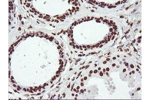 Immunohistochemical staining of paraffin-embedded Human breast tissue using anti-FBXO21 mouse monoclonal antibody. (FBXO21 抗体)