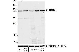 Western Blotting (WB) image for anti-AT Rich Interactive Domain 2 (ARID, RFX-Like) (ARID2) (AA 1785-1835) antibody (ABIN7449532)