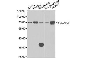 Western blot analysis of extracts of various cell lines, using SLC20A2 antibody. (SLC20A2 抗体  (AA 235-485))