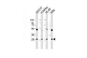 Western Blot at 1:2000 dilution Lane 1: 293T/17 whole cell lysate Lane 2: human kidney lysate Lane 3: HL-60 whole cell lysate Lane 4: K562 whole cell lysate Lysates/proteins at 20 ug per lane. (ARV1 抗体  (N-Term))